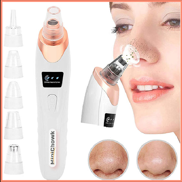 5-in-1 Blackhead remover
